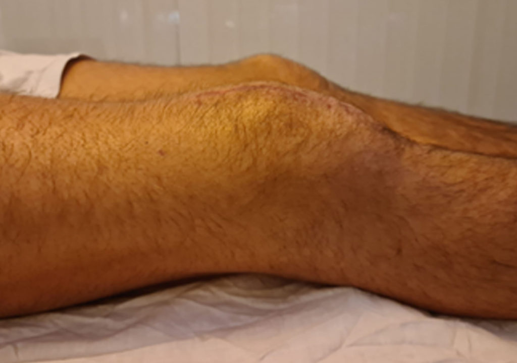 Sports-Physiotherapy_1_After_2-1024×720