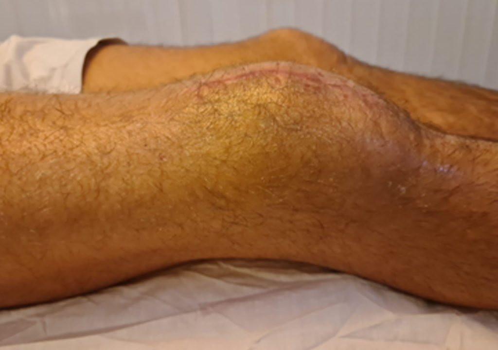 Sports-Physiotherapy_1_Before_2-1024×720