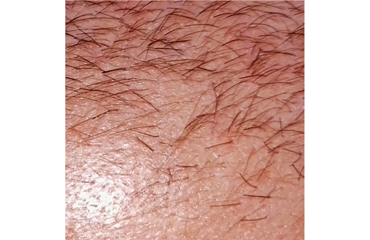 idc_0001s_0001_S