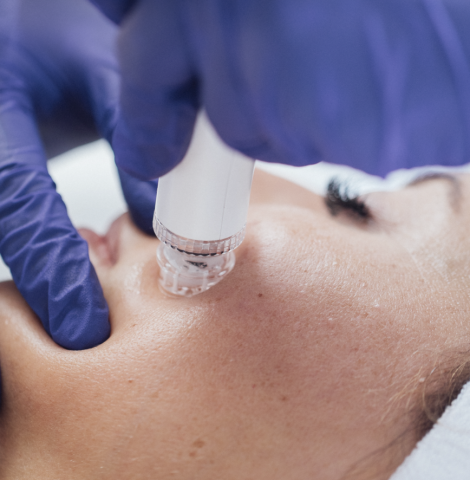 tratamiento-ona-1_original-1024x886